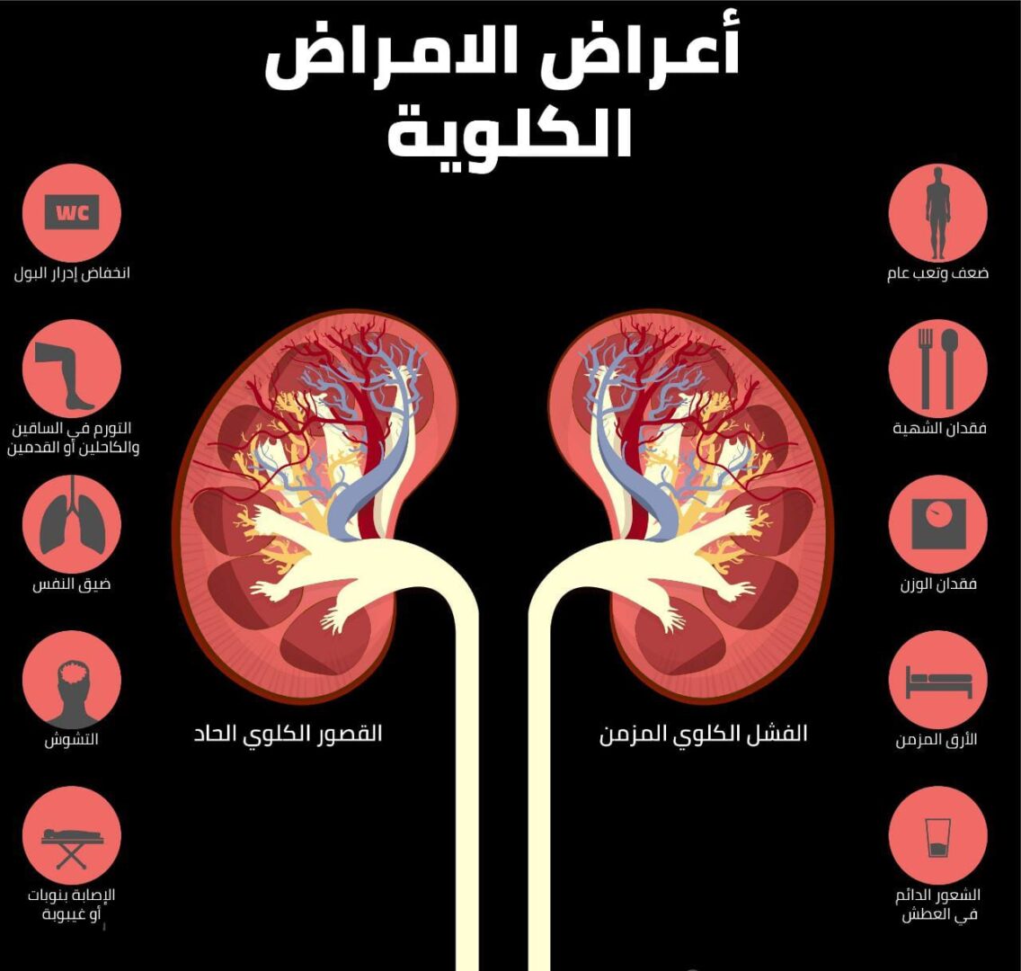 الفشل الكلوى ماهى أعراض والوقاية منه
