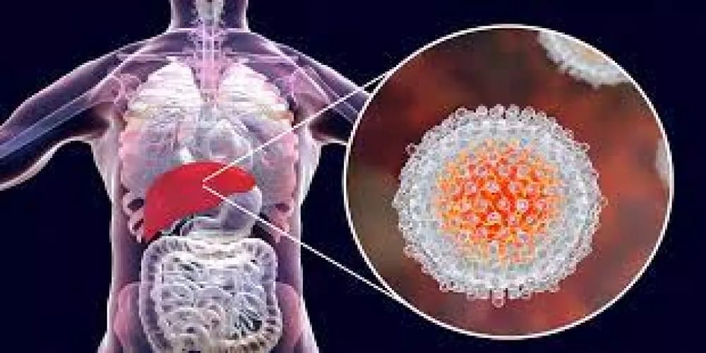 أعراض ومسببات وطرق الوقاية من فيروس C